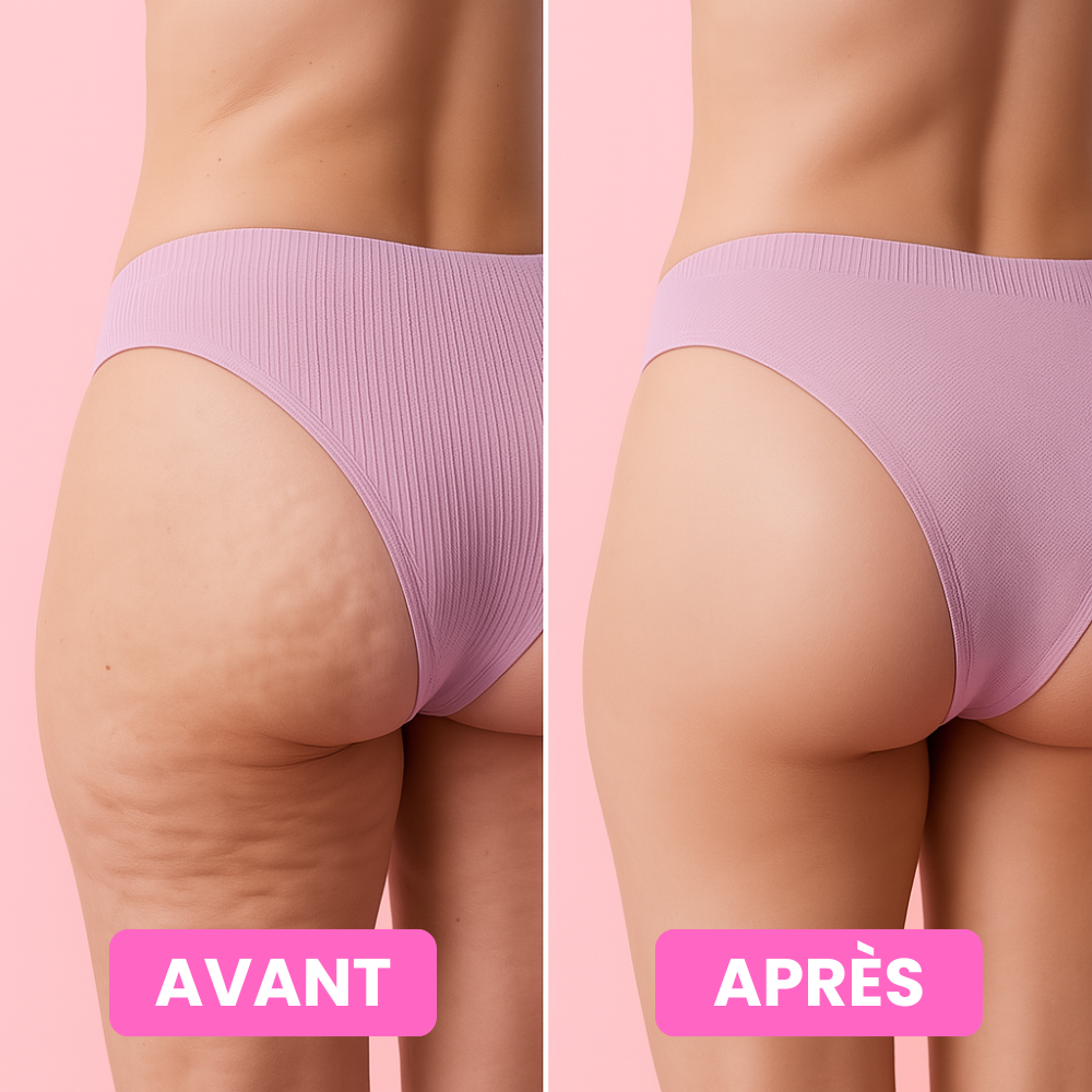 Slimélya® 100 % naturlig anticellulitkräm (-70%)